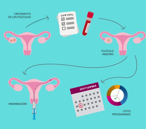 Inducción a la ovulación | Profert
