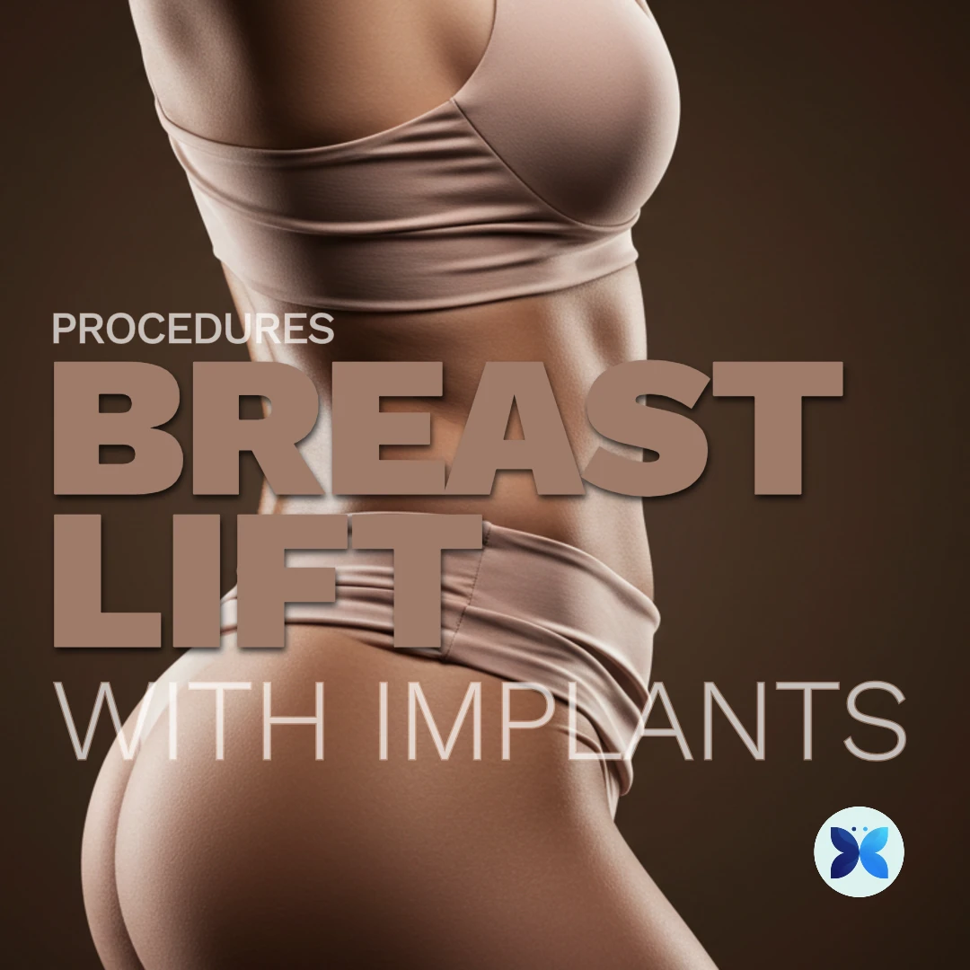 Breast lift with implants | Metamorfosis @ Medii.net, breast lift with implant