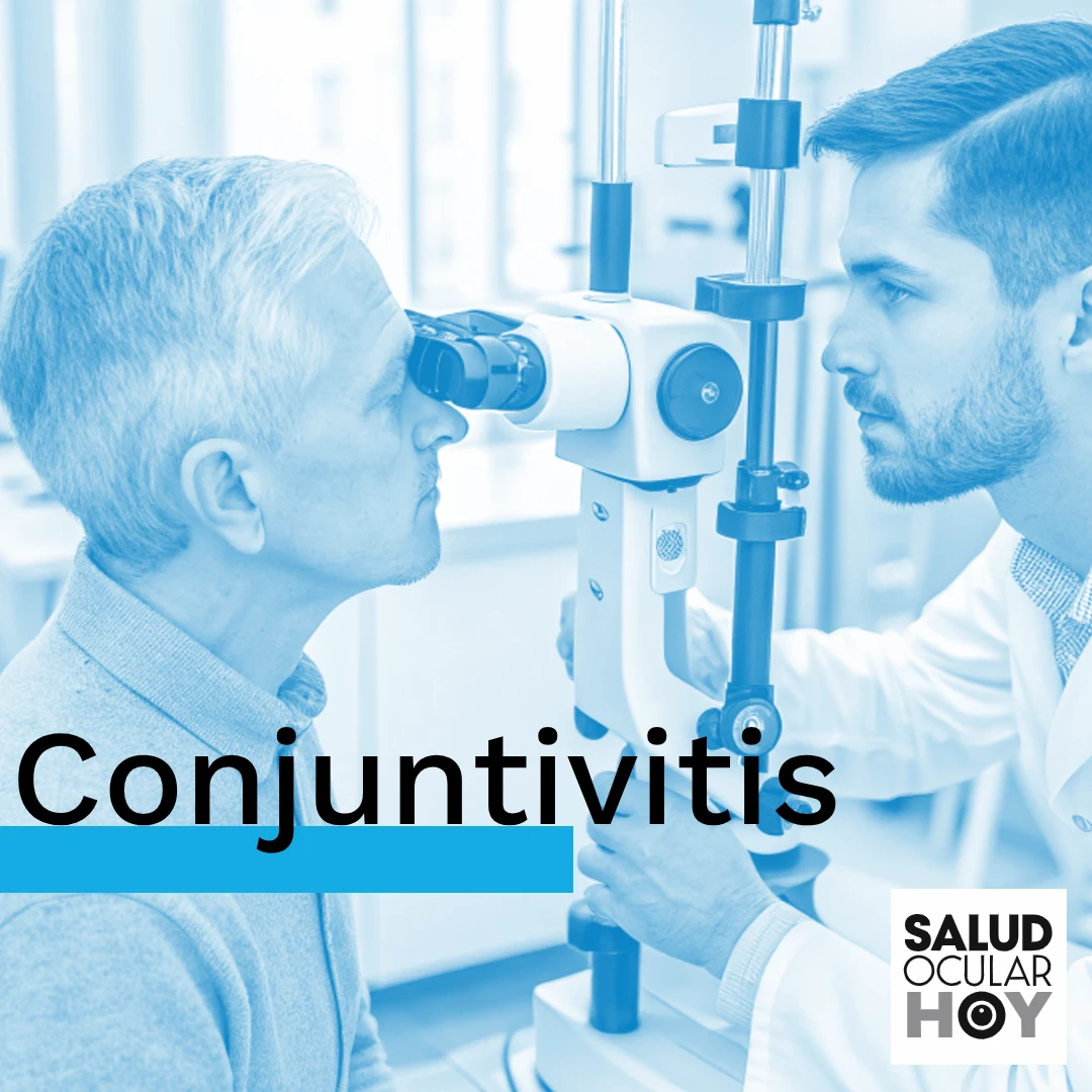 Conjuntivitis - causas, síntomas y cuándo consultar con un oftalmólogo, Salud Ocular Hoy @ Medii
